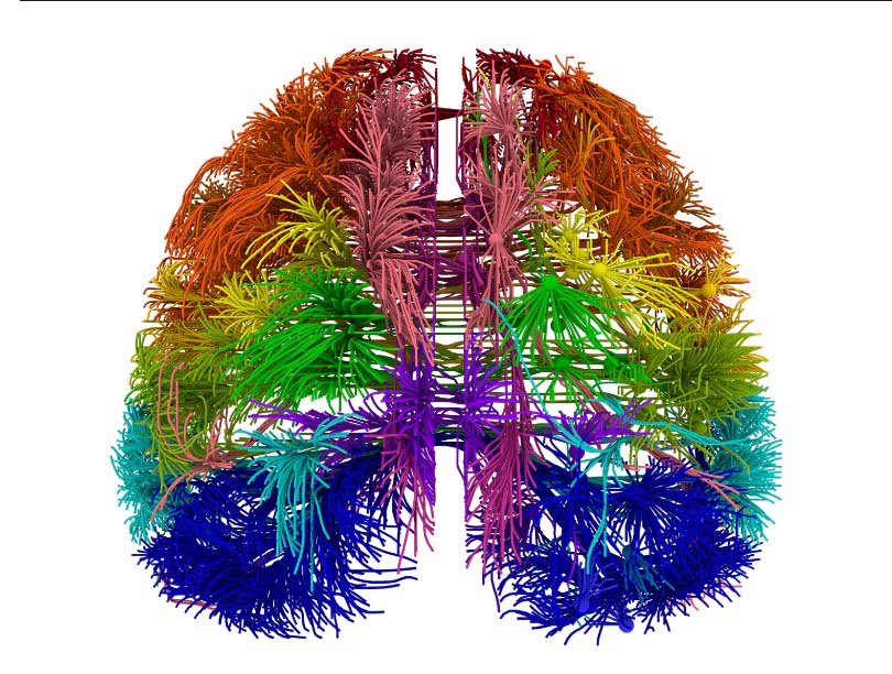 The Neuroscience Of Open Mindedness Related To Political Views